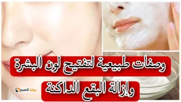 ماسك العسل لتفتيح البشرة وزيادة نضارتها “الكل هيسألك عن سر جمالك”