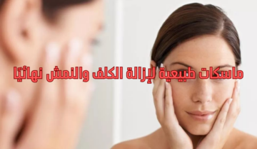 ماسكات طبيعية لإزالة الكلف والنمش نهائيًا جربيها للتخلص من التصبغات والحصول على بشرة نضرة