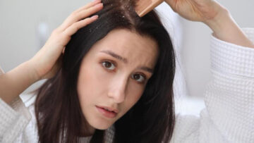 كيفي تتخلصين من قشرة الشعر بمكونات طبيعية من منزلك