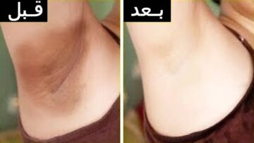 وصفات منزلية طبيعية تخلصك من اسمرار المناطق الداكنة بالجسم من أول مرة