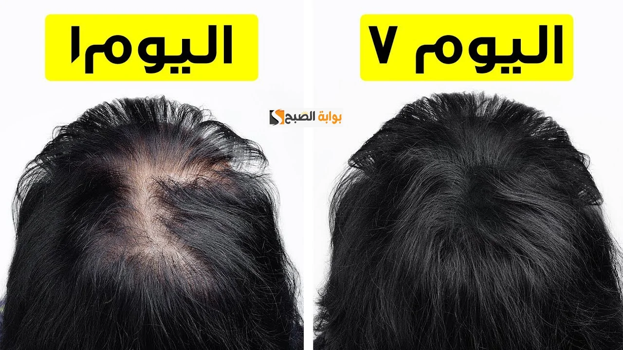 نبتة طبيعية بالقرب منك ستغير مسار حياتك للأبد تعلم استخدامها على الشعر بتلك الطريقة “نتائج تفوق حد توقعاتك”