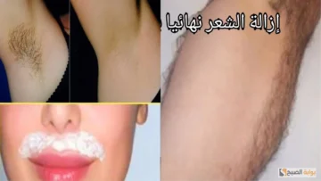 اقوي من السويت.. بملعقة ملح وفازلين تخلصي من شعر الوجه والجسم كله من الجذور بدون اي الم وتبييض فوري للمناطق الداكنة