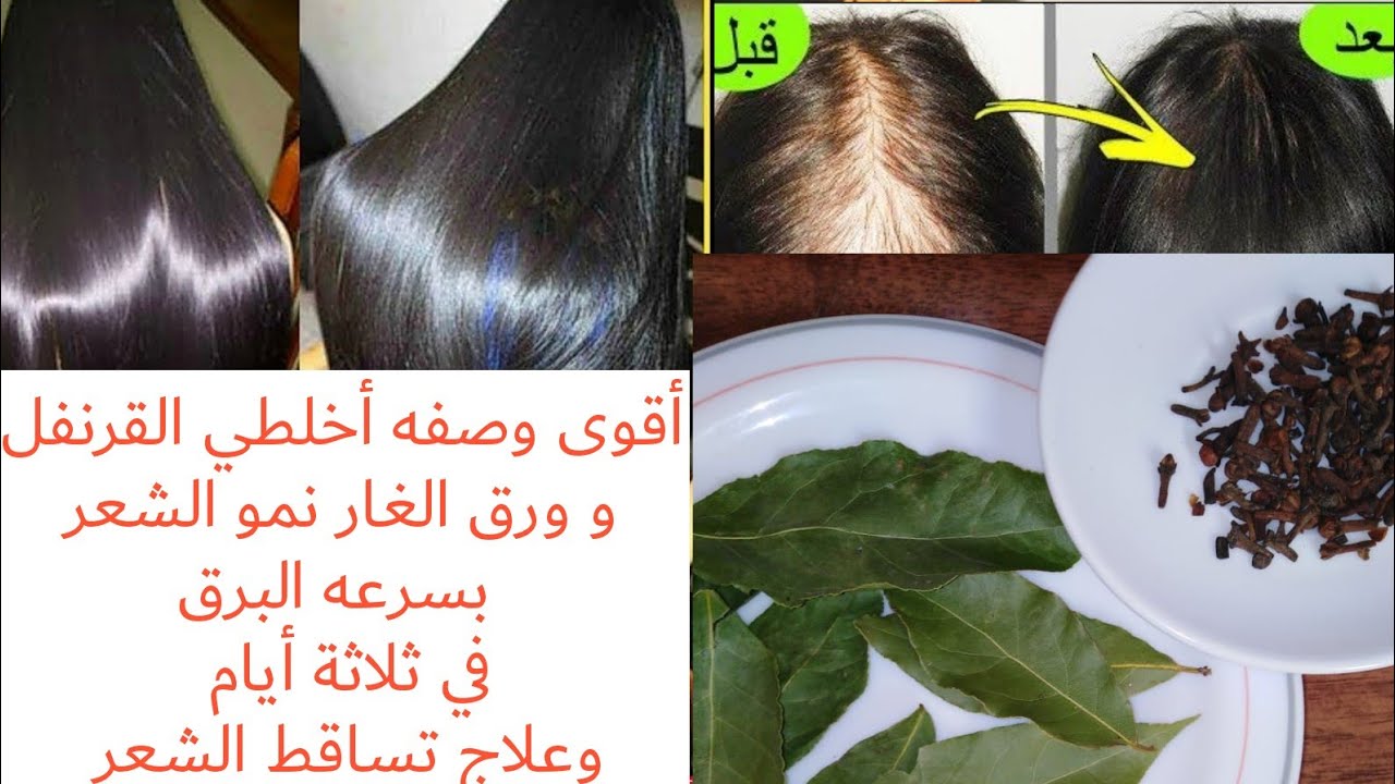 هترجعي بنت العشرين..وصفة ورق الغار مع القرنفل هتخليكى ملكة جمال وهتغير حياتك 180 درجة هتندمي انك معرفتهاش من زمان