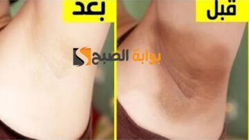تخلصي من سواد 20 سنة وصفة لتبييض المناطق الحساسة من اول استعمال حتى لو كانت زي الفحم
