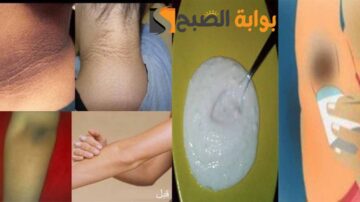 السواد هيختفي وصفة لتبييض المناطق الحساسة من اول استعمال تفتيح فوري في 5 دقائق