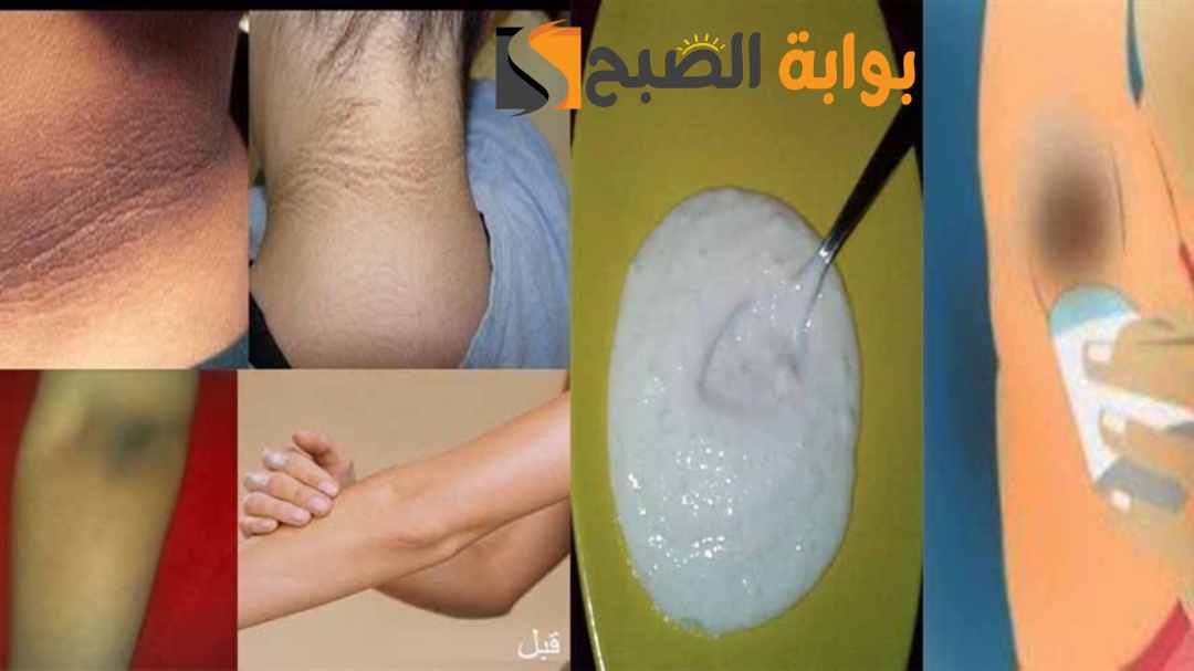 السواد هيختفي وصفة لتبييض المناطق الحساسة من اول استعمال تفتيح فوري في 5 دقائق 5 السواد هيختفي وصفة لتبييض المناطق الحساسة من اول استعمال تفتيح فوري في 5 دقائق