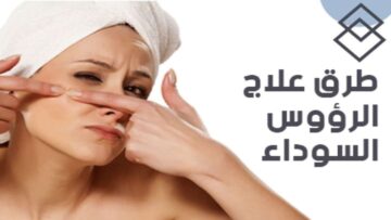أسرع طريقة لإزالة الرؤوس السوداء والتجاعيد بوصفات طبيعية وباقل التكاليف
