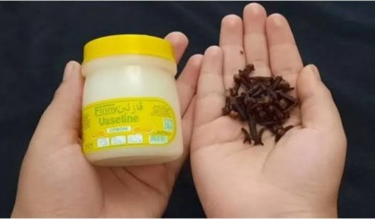 كنز في البيت عندك.. حطي الفازلين على القرنفل بالطريقة دي لنتيجة خيالية 5 كنز في البيت عندك.. حطي الفازلين على القرنفل بالطريقة دي لنتيجة خيالية