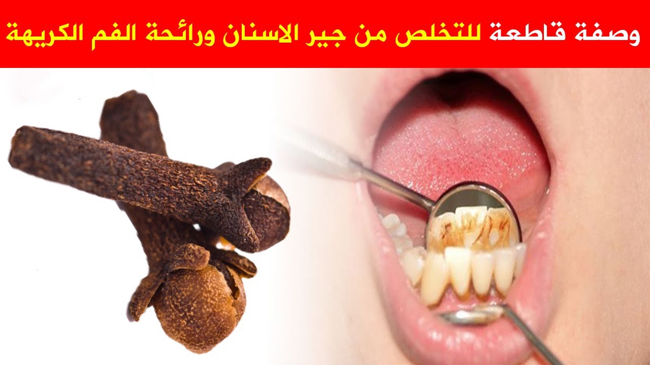 أربع وصفات طبيعية للتخلص من رائحة الفم الكريهة والحصول على نفس منعش 5 أربع وصفات طبيعية للتخلص من رائحة الفم الكريهة والحصول على نفس منعش