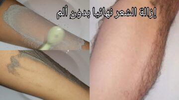 اقوي من الليزر والسويت.. خلطة رماد الفحم الجبارة لإزالة شعر الوجه والجسم كله من الجذور بدون الم نهائي وتبييض المناطق الداكنة