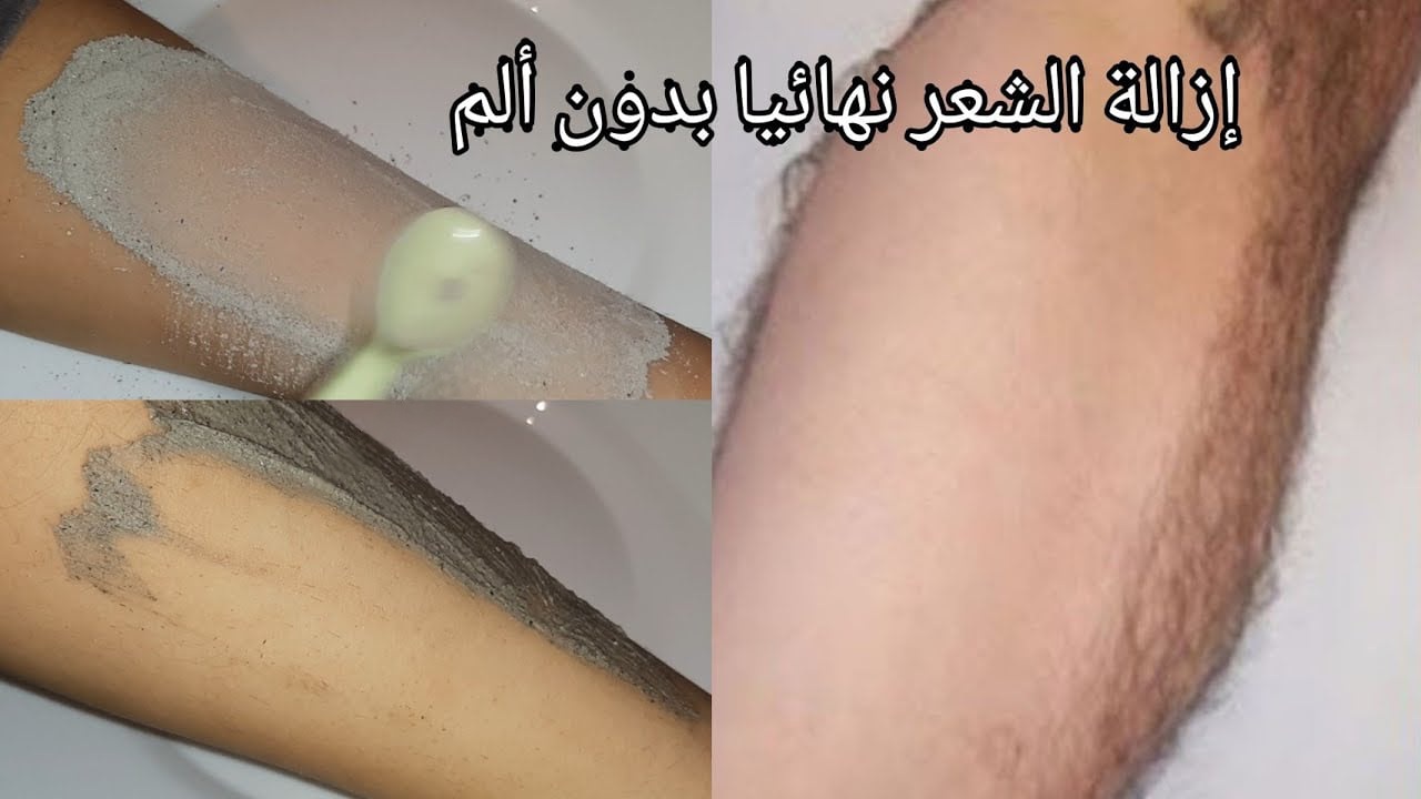 اقوي من الليزر والسويت.. خلطة رماد الفحم الجبارة لإزالة شعر الوجه والجسم كله من الجذور بدون الم نهائي وتبييض المناطق الداكنة 5 اقوي من الليزر والسويت.. خلطة رماد الفحم الجبارة لإزالة شعر الوجه والجسم كله من الجذور بدون الم نهائي وتبييض المناطق الداكنة