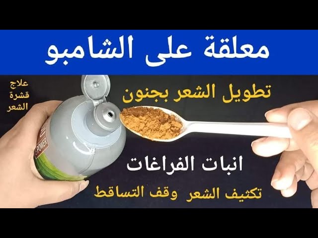 مكون خارق ضعيه على الشامبو شعرك هينمو بغزارة انبات وتكثيف سحري للشعر القصير هتشوفي نتيجة سحرية