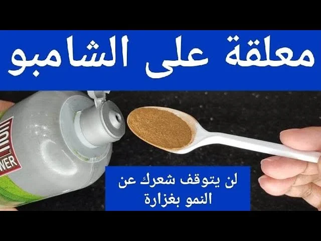 ينمو بغزارة.. مكون رهيب ضعيه في الشامبو الخاص بك لتسريع نمو وتطويل الشعر ووقف الصلع