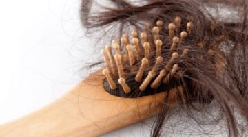 أعشاب لعلاج تساقط الشعر
