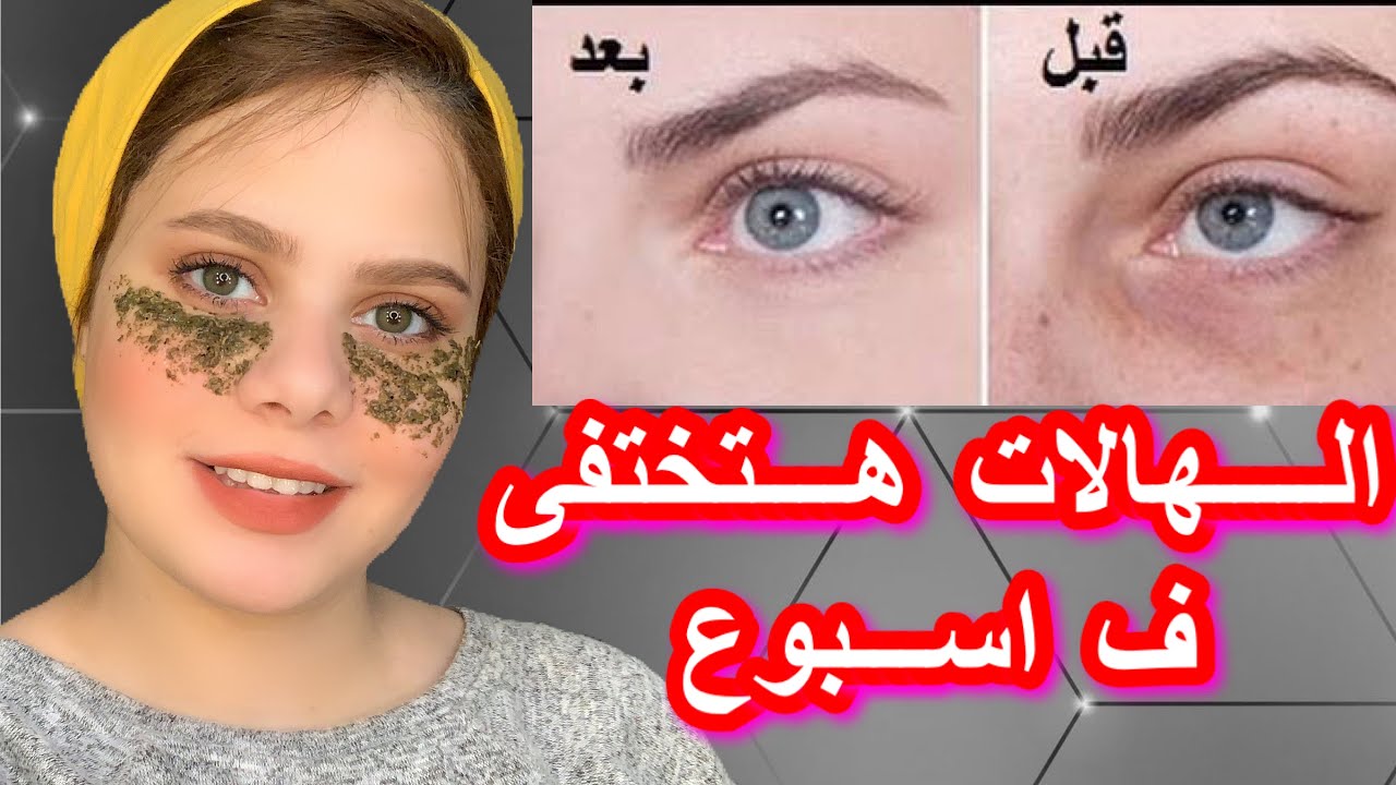 كل الاسمرار هيختفي.. وصفة البطاطس للهالات السوداء وحب الشباب بشرتك هتبقى زي البنور.. وشك هينور 5 كل الاسمرار هيختفي.. وصفة البطاطس للهالات السوداء وحب الشباب بشرتك هتبقى زي البنور.. وشك هينور