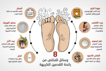 طريقة التخلص من رائحة القدمين بمكونات بسيطة ونصائح تخلصك من الرائحة