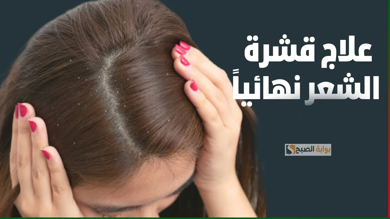 وداعا لتساقط الشعر.. وصفات طبيعية للتخلص من قشرة الشعر منها زيت جوز الهند والشاي الأخضر