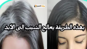 وداعا للشعر الأبيض.. طريقة للتخلص من الشعر الابيض بالليمون الشيب هيختفي بدون صبغات كيميائية