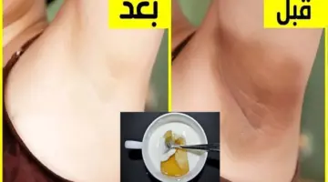 تبيض المناطق الحساسة