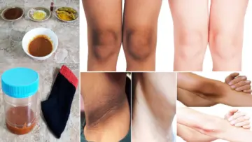 هيحسدوكي من جمالك.. تبييض الجسم والبشرة بوصفات قوية منزلية نتيجة فعالة من اول استخدام