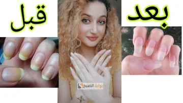 هترجع بتبرق.. طرق طبيعية لتفتيح الأظافر “تخلصى من اللون الأصفر بخطوات بسيطة”