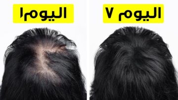 بدون كوافير ولا مشاورير.. وصفة لعلاج الشعر الخفيف هيتقل من تاني وبدون تعب