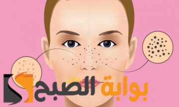 “خلي وشك ينور” أقوى 3 وصفات تنظيف الوجه والأنف من الرؤوس السوداء