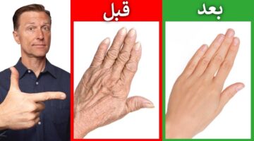 تنعيم اليدين 1