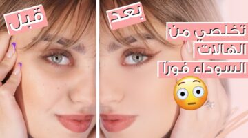 خلطات طبيعية للتخلص من الهالات والتجاعيد