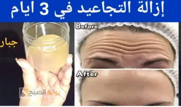 اصنعي بنفسك في المنزل.. وصفة سحرية لعمل كولاجين طبيعي يساهم في ازالة التجاعيد وإعادة بناء خلايا البشرة من بذور مش هتخطر على بالك