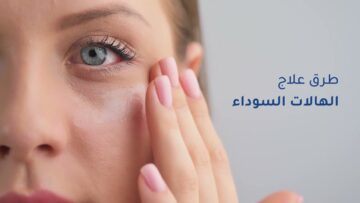 نتيجة مبهرة وغير مكلفة.. طرق طبيعية للعناية بمنطقة تحت العين