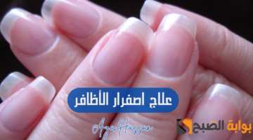 طرق علاج إصفرار الأظافر