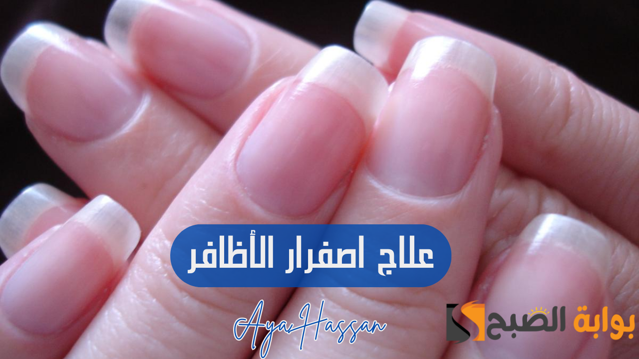 “مشكلتك حلها عندنا”.. وصفات للتخلص من اصفرار الاظافر بشكل نهائي