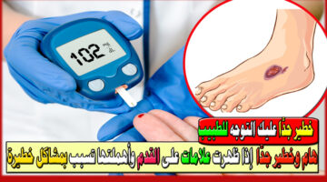 علامات قد تشير إلى إصابتك بمرض السكري