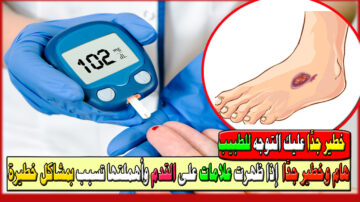 خطير جدًا عليك التوجه للطبيب بأسرع ما يمكن إذا ظهرت علامات على القدم وأهملتها تسبب بمشاكل خطيرة بالصور