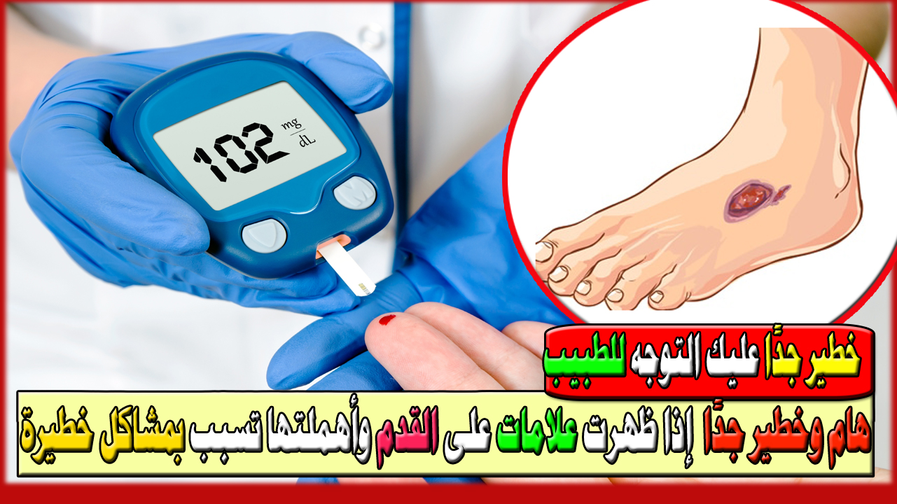 خطير جدًا عليك التوجه للطبيب بأسرع ما يمكن إذا ظهرت علامات على القدم وأهملتها تسبب بمشاكل خطيرة بالصور 6 خطير جدًا عليك التوجه للطبيب بأسرع ما يمكن إذا ظهرت علامات على القدم وأهملتها تسبب بمشاكل خطيرة بالصور