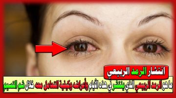 ما هو الرمد الربيعي الذي ينتشر في هذه الأيام وأعراضه وكيفية التعامل معه خلال شم النسيم