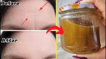 وشك هينور وهتبقي قمر.. أقوي كولاجين طبيعي لشد وتبييض الوجه وإزالة البقع والتصبغات والجلد الميت هتنوري