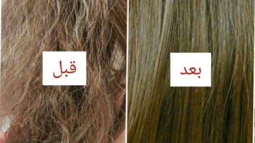 وصفات طبيعية لعلاج هيشان الشعر بأقل تكلفة