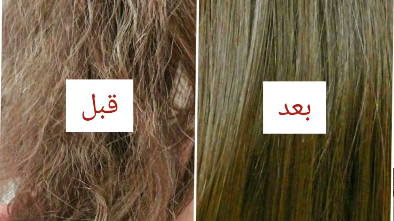 وصفات طبيعية لعلاج هيشان الشعر بأقل تكلفة