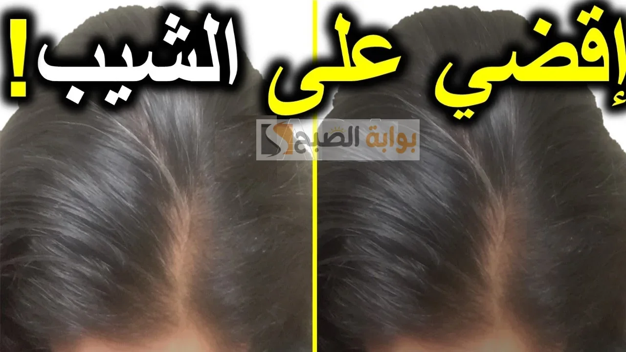 أقوى وصفة للتخلص من الشعر الأبيض في أقل من ٢٠ دقيقة وبدون صبغات كيميائية 2 أقوى وصفة للتخلص من الشعر الأبيض في أقل من ٢٠ دقيقة وبدون صبغات كيميائية