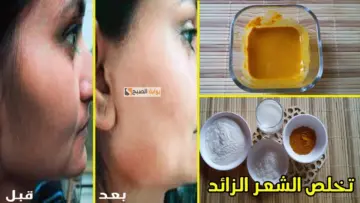 هتبقى أنعم من الحرير.. طريقة سهلة وسريعة لإزالة الشعر الزائد من البشرة والجسم بدون ألم في أقل من ساعة هتبقى فلة