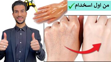 هتبقي ناعمة زي الأطفال.. خلطة النشا لتبييض اليدين من حروق الشمس والتخلص من الجلد الميت والبقع المتراكمة في ثواني هتبقي قمر 14