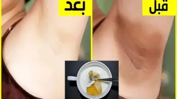لو فرحك قرب.. خلطة طبيعية كالسحر لتبييض المناطق الحساسة 10 درجات تقضي علي السواد المتراكم في دقيقتين هتخليكي بيضاء صافية قشطة