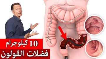 مش هتروح لدكتور تانى.. تنظيف القولون من التراكمات وسموم الجسم بدون ادويه وبطريقة طبيعية