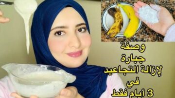 حلاوتك راجعة من تاني.. طريقة مدهشة لاستخدام قشر الموز في التخلص من التجاعيد