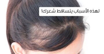 ما هي أسباب تساقط الشعر بكثرة عند النساء؟ طرق العلاج والوقاية