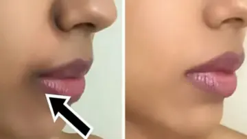 أفضل الخلطات الطبيعية للتخلص من الاسمرار حول الفم في أقل وقت!