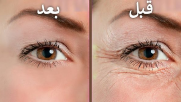 أفضل وصفة للتجاعيد والخطوط الرفيعة هترجعلك شبابك تاني بأقل تكلفة