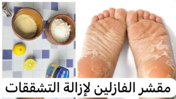 هاتي ملعقتين فازلين وتعالي أقولك أزاي تخلي كعب رجلك قشطة وتزيلي التشققات والقشور في دقائق